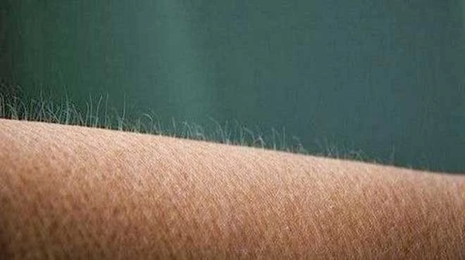 Τρίχες που γυρίζουν προς τα μέσα – Γλίτωσε εύκολα και γρήγορα